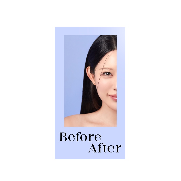 Before After (Highlight Ver.)
